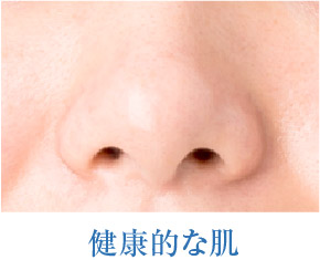 健康的な肌