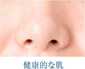 健康な肌